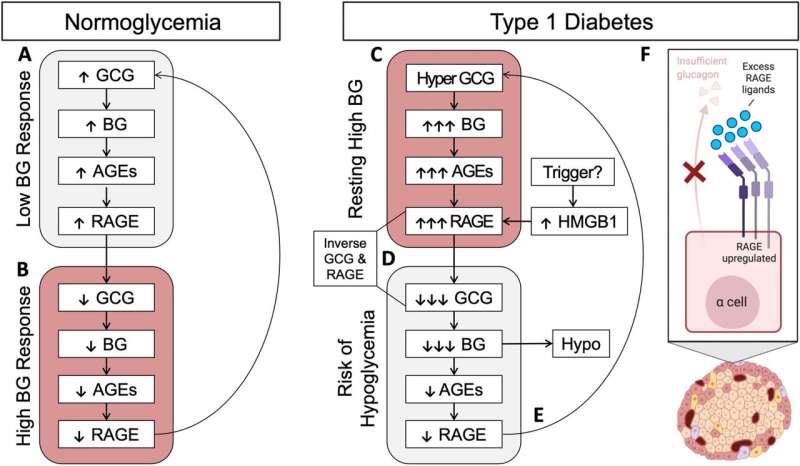 Researchers discover new link to pancreatic hormone in Type 1 diabetes