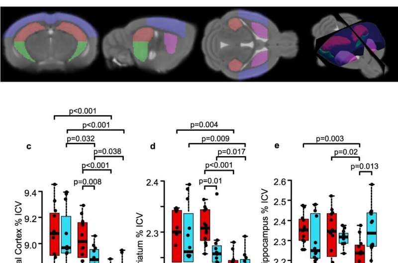 Menopausal hormone changes linked to cognitive deficits 