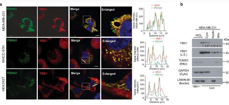 PBX1 as a key regulator of mitochondrial pyruvate uptake