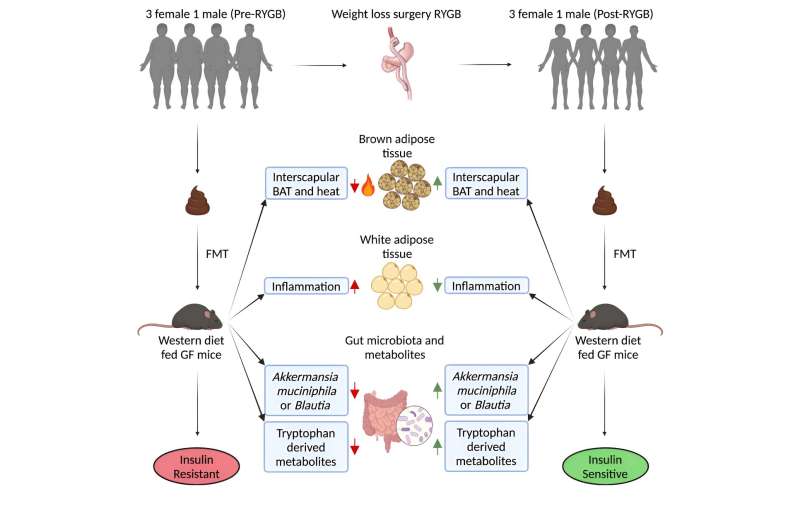 Researchers explore changes to microbiome following weight-loss surgery