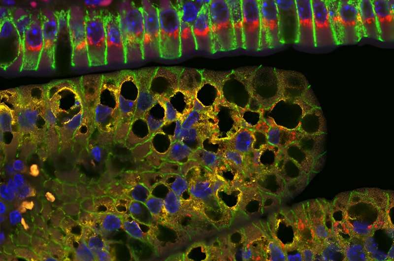 Study unveils a role of mitochondria in dietary fat processing