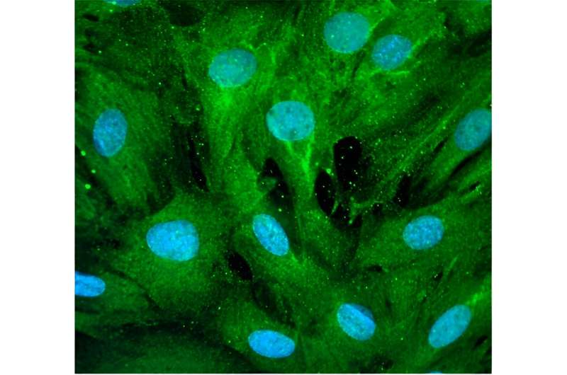 Investigating the Role of DNA Damage in Cardiac Hypertrophy