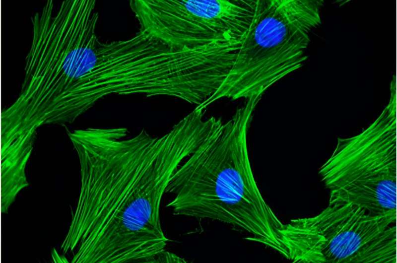 Investigating the Role of DNA Damage in Cardiac Hypertrophy