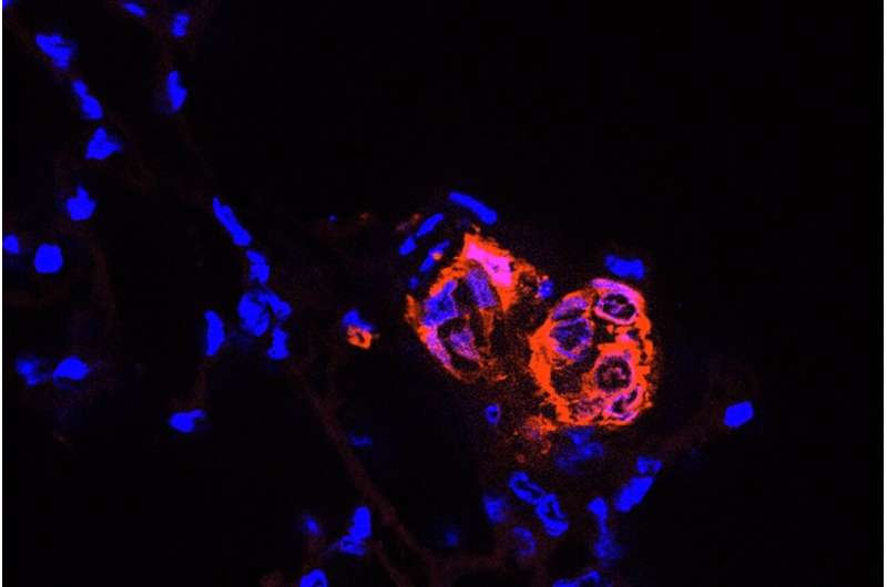 The molecules behind metastasis