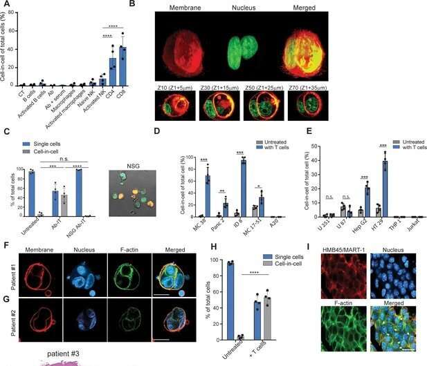 Tumors form temporary structures to avoid immunotherapy treatments