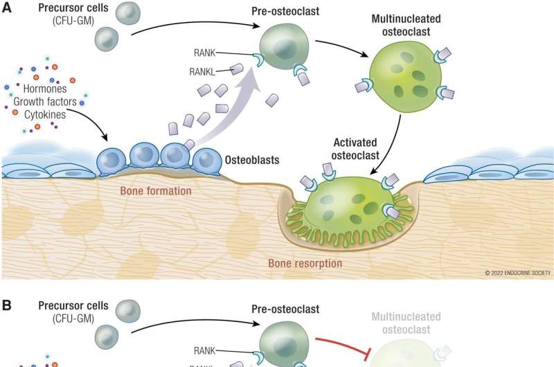 Experts explain treatment options for a common cancer complication