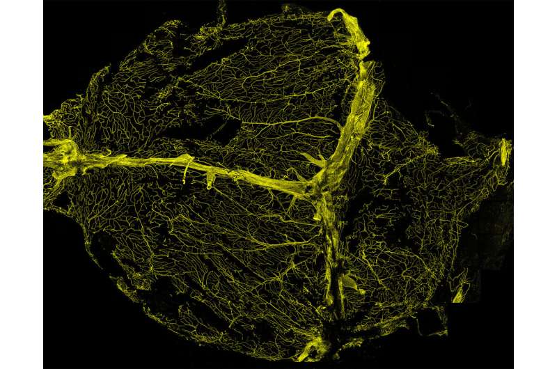 Salty immune cells surrounding the brain linked to hypertension-induced dementia