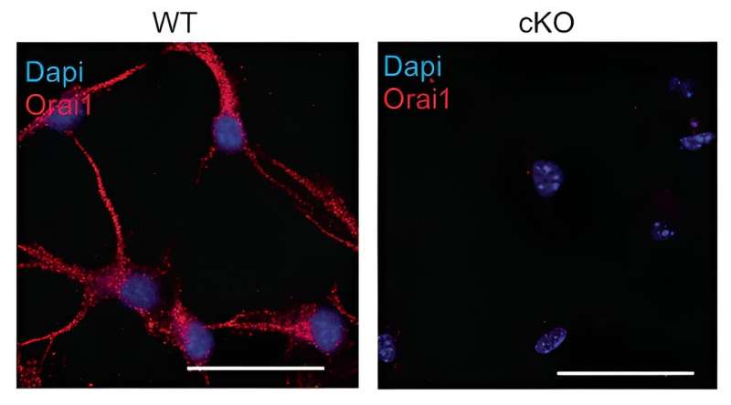 Ion channel linked to brain inflammation identified