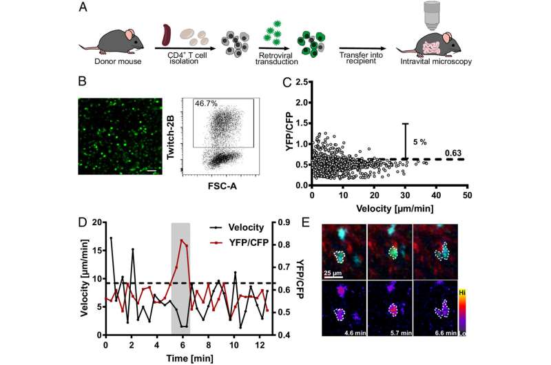 Multiple sclerosis: Fateful immune cell activation in gut made visible