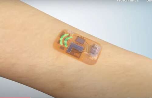 Wearable sweat sensor detects molecular hallmark of inflammation