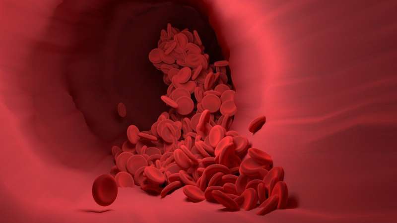 Preliminary study: Blood treatment is safe, may help treat stiff person syndrome