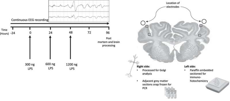 How inflammation affects brain development