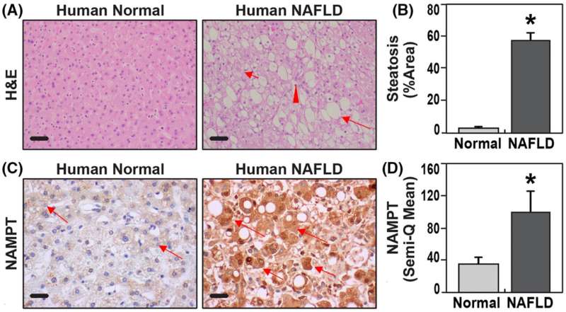 Inflammation-targeting antibody found to improve preterm birth outcomes, prevent obesity-linked liver disease