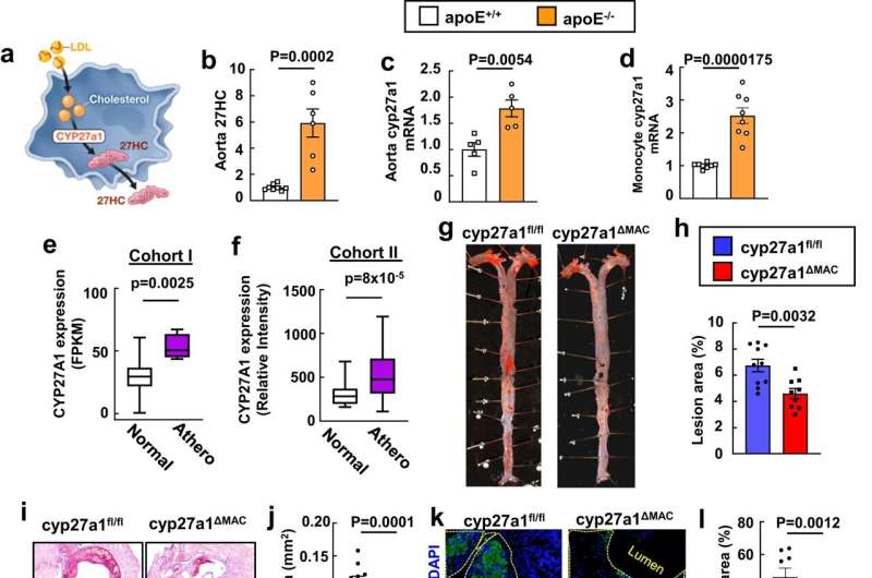 Research pinpoints inflammation source behind atherosclerosis