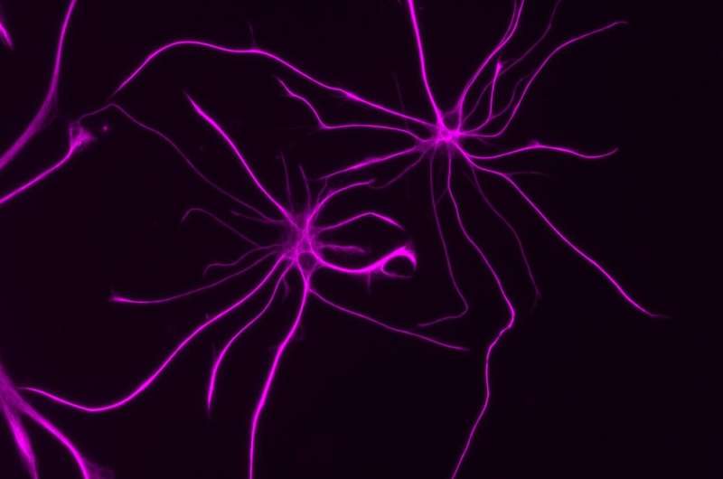 Beyond neurons: How cells called astrocytes contribute to brain disorders