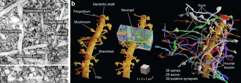 Large collaboration yields unprecedented 'live' view into the brain's complexity