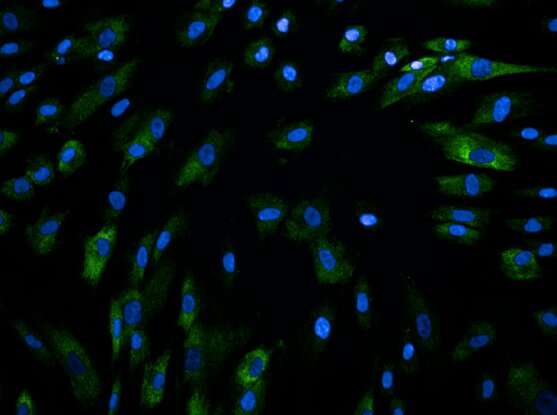 Single-cell analysis of Crohn's disease reveals a detailed picture of inflammation in the gut