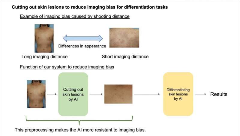 AI model helps atopic dermatitis patients diagnose complications and malignant diseases