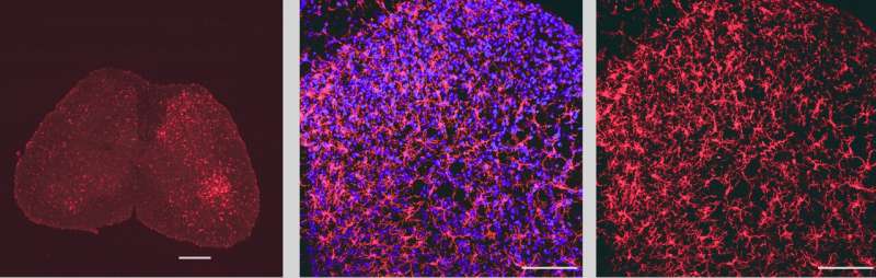 Calcium channels regulate neuroinflammation and neuropathic pain 