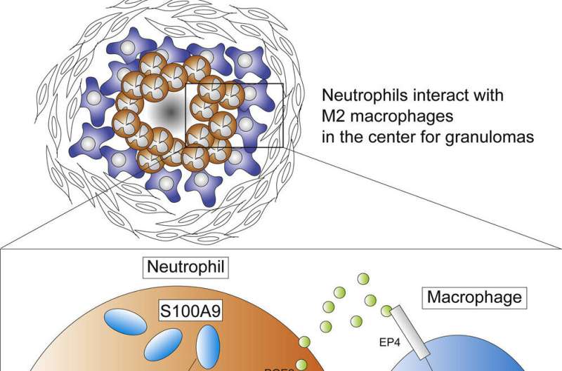 In search of the 'inflammatory Achilles heel'