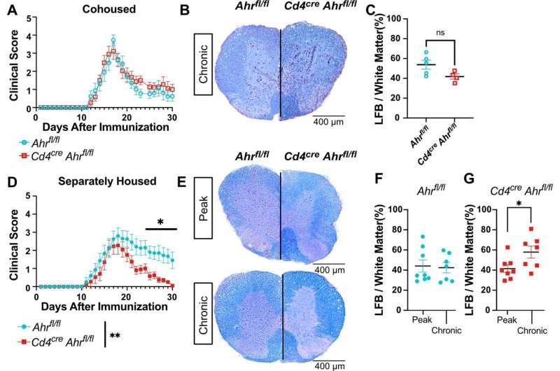 Multiple sclerosis discovery could end disease's chronic inflammation