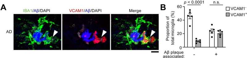 Scientists discover promising target for Alzheimer's disease treatment 