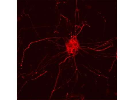 Modulation of brain cholesterol: A new line of research in Alzheimer's disease treatment?