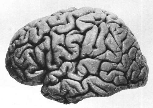 brain