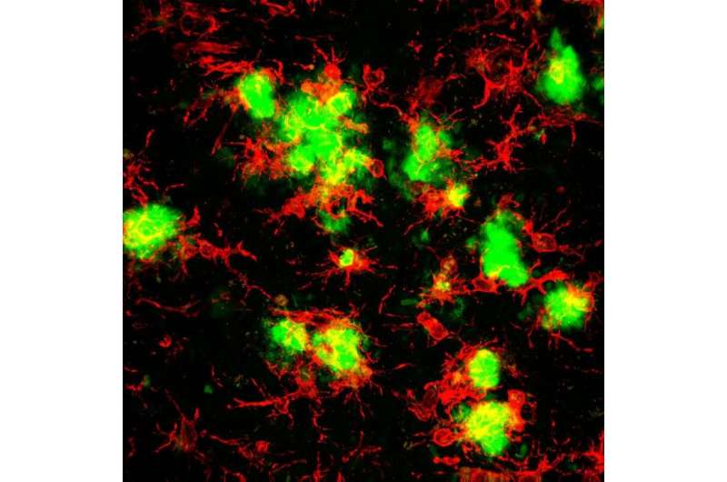 Blocking inflammation prevents cell death, improves memory in Alzheimer's disease 