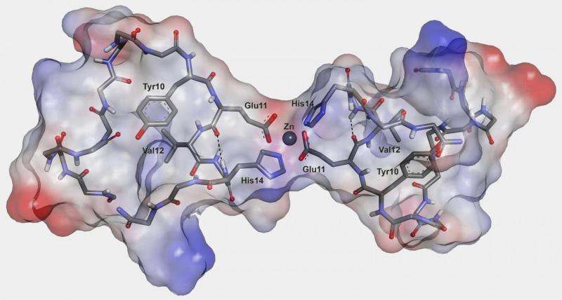 Scientists discover a trigger of Alzheimer's disease 