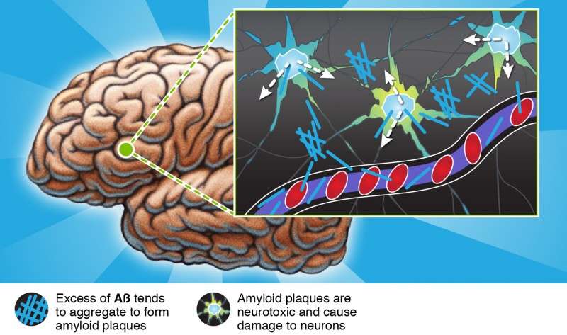 A participatory research project tackling Alzheimer’s disease