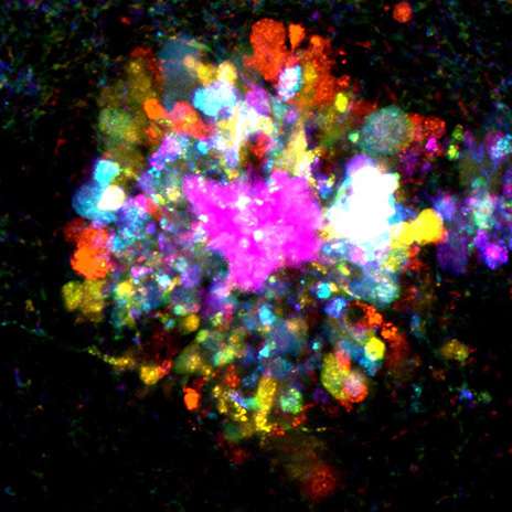 Image: Neurologist creates image of Alzheimer's plaque in neurons 