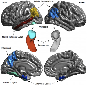 The search for early markers of Alzheimer's Disease 