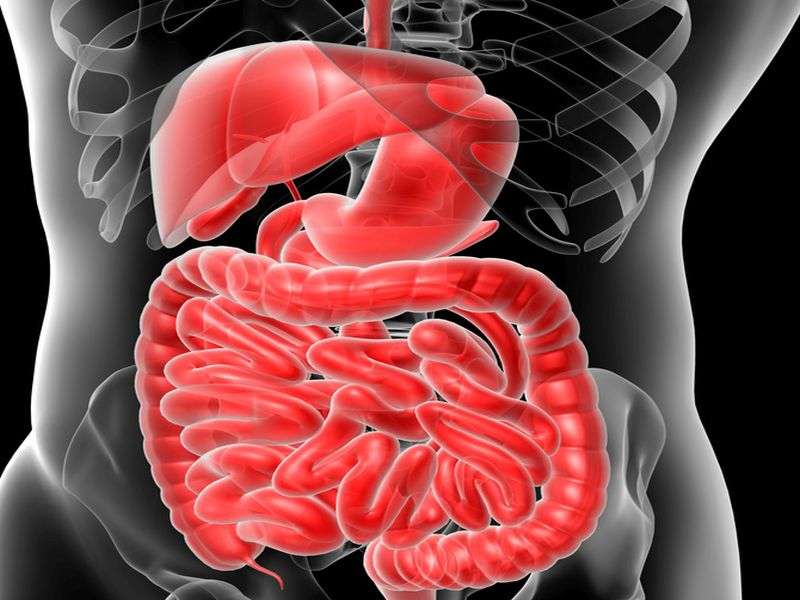 Colonic diverticular disease linked to dementia risk 