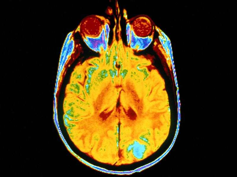 Neuronal heparan sulfates play role in amyloid pathology 