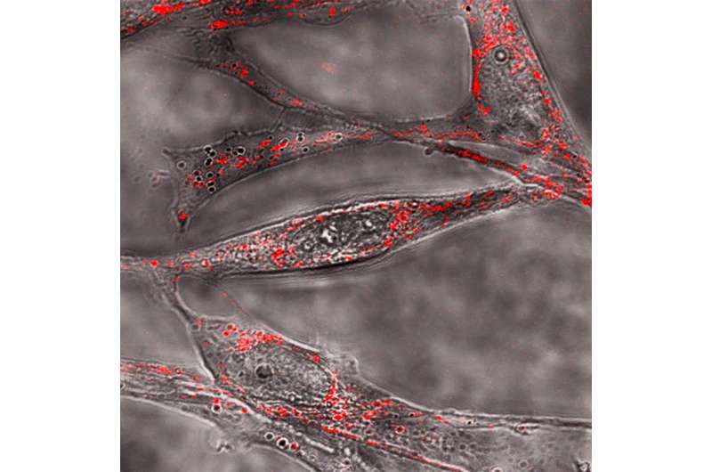 The evolution of amyloid toxicity in Alzheimer's 