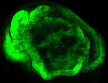 Genes activated in metastasis also drive the first stages of tumour growth