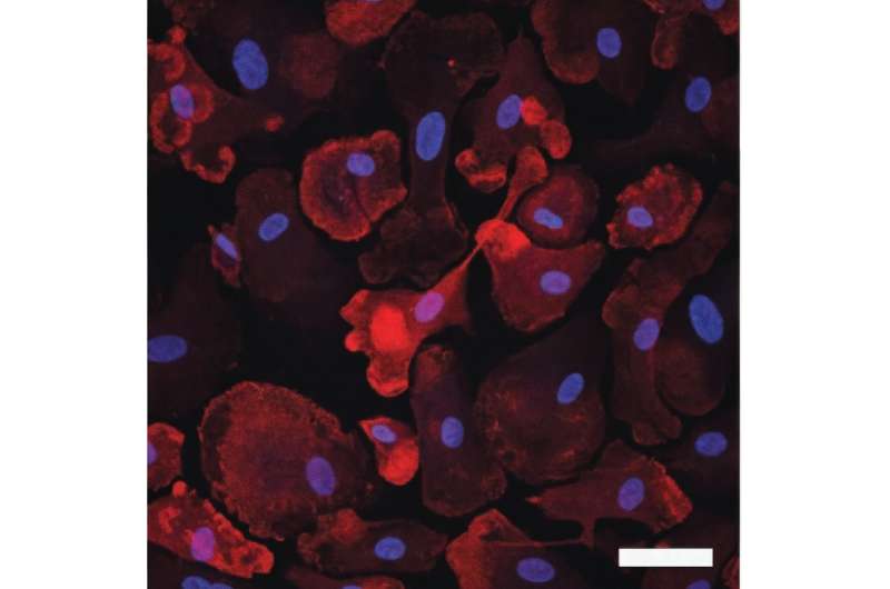 Researchers connect Alzheimer's-associated genetic variants with brain cell function 