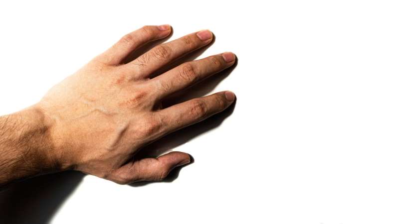 New research reveals link between finger tapping and Alzheimer's 