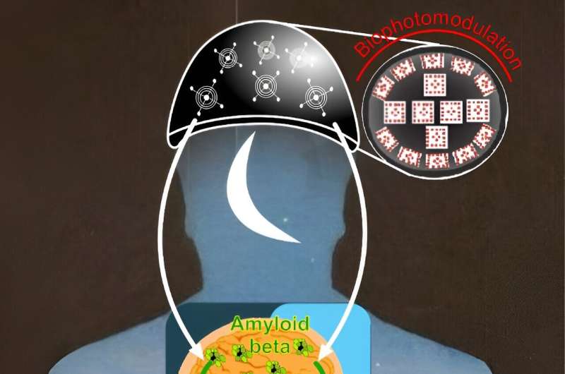 Mechanisms of phototherapy of Alzheimer's disease during sleep and wakefulness 