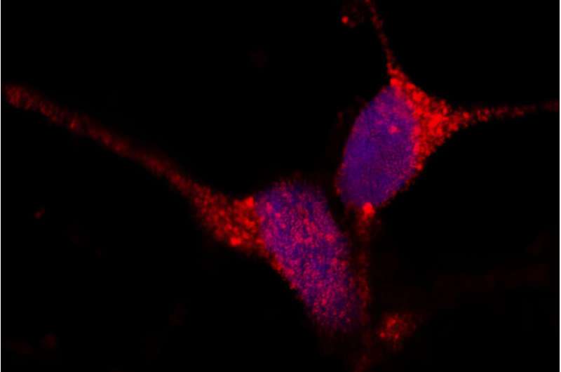 ssResearchers identify key steps to toxic protein accumulation in Alzheimer's and other diseases  