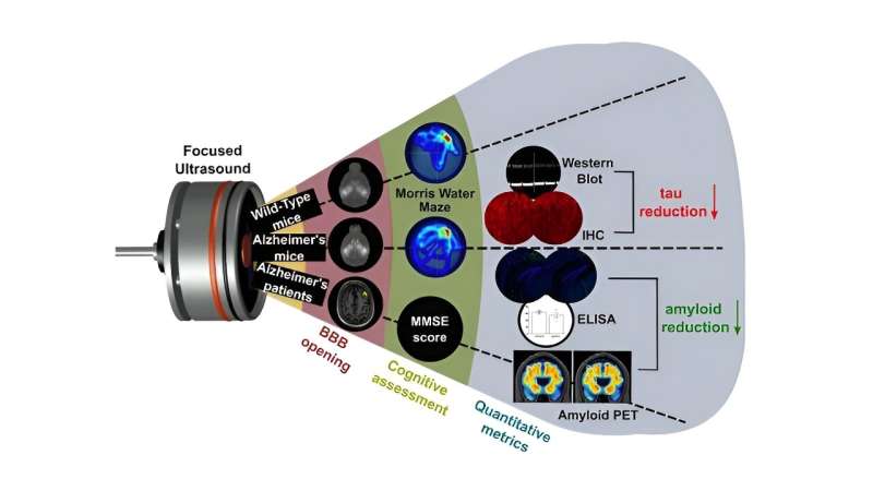 Using focused ultrasound to treat Alzheimer's and Parkinson's