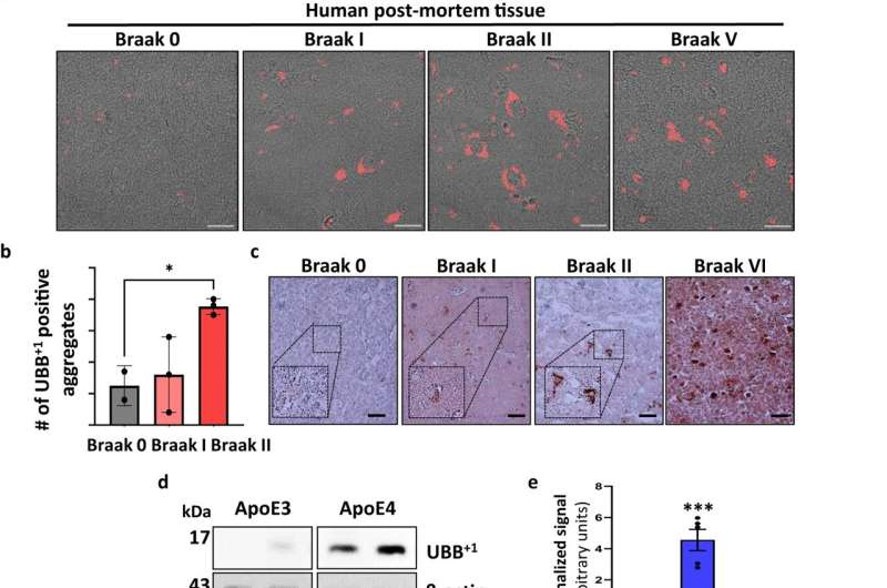 Protein experts show altered ubiquitin signaling induces hallmarks of sporadic Alzheimer's disease 