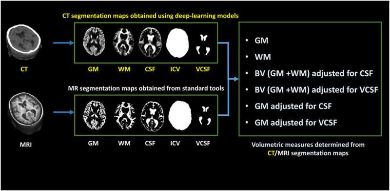 Smarter CT scans may approach the level of MRI