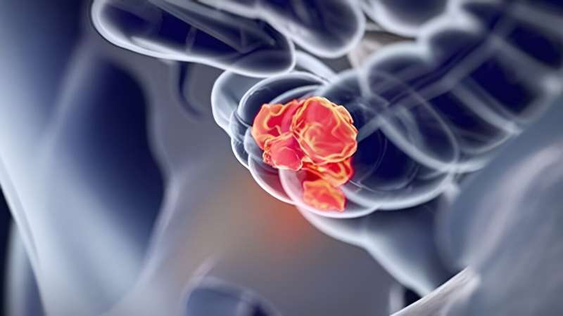 ctDNA-based detection of residual disease prognostic for resected CRC 