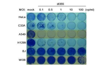 Engineering a cancer-fighting virus