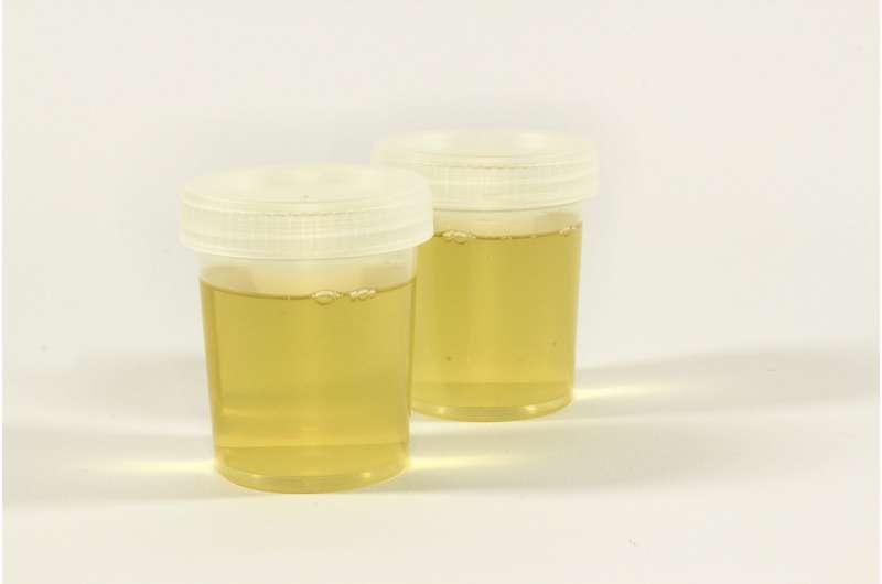 urine test