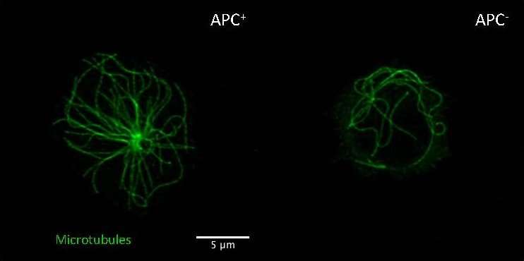 Colon cancer: APC protein affects immunity by preventing pre-cancerous inflammation