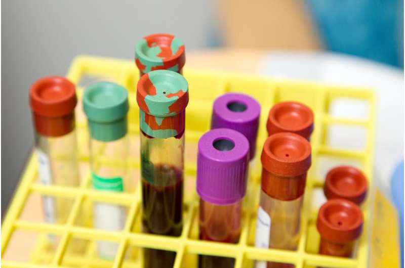 Alzheimer's blood test found to perform as well as FDA-approved spinal fluid tests