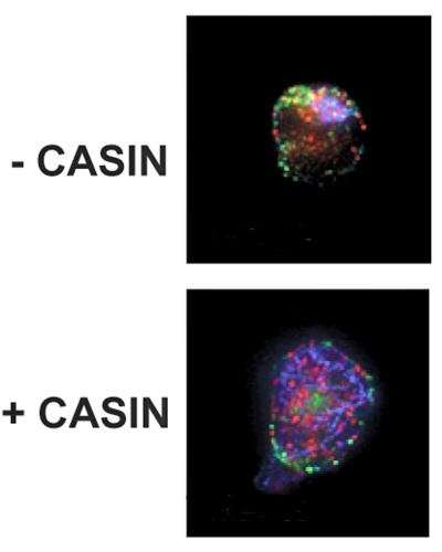 Two studies describe improved approach to bone marrow transplant